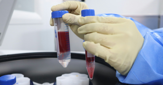 What's Going On When Your Hips Are Making Noise?